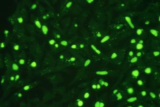 Microscopic view of chlamydia