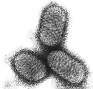 Orf virus is the most important poxvirus in the UK