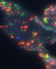 Bacteria attached to fibre particles in the large intestine